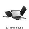 Dell Inspiron 5567 notebook 15,6 FHD i5-7200U