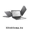 Dell Inspiron 5567 notebook 15,6 i3-7100U 4GB