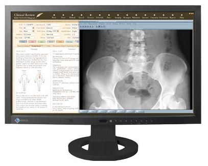 monitor 23  DICOM-Prester fotó, illusztráció : MS230W