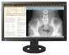 Eizo orvosi monitor leletezéshez 23 DICOM-Pres