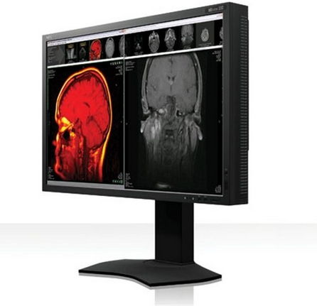 MedicalDisplay MDview232 2,07MP 23 16:9 monitor IPS LED, 1000:1, 1920x1024, 250 fotó, illusztráció : NEC-60003189