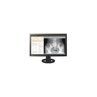 monitor 23" DICOM-Prester MS230W fotó