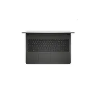 Dell Inspiron 5559 notebook 15,6  i5-6200U 8GB 1TB R5-M335 Win10H illusztráció, fotó 2