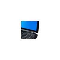 ASUS 15,6  laptop Intel Celeron 220 1,2GHz/2GB/250GB/DVD író notebook 2 év illusztráció, fotó 3